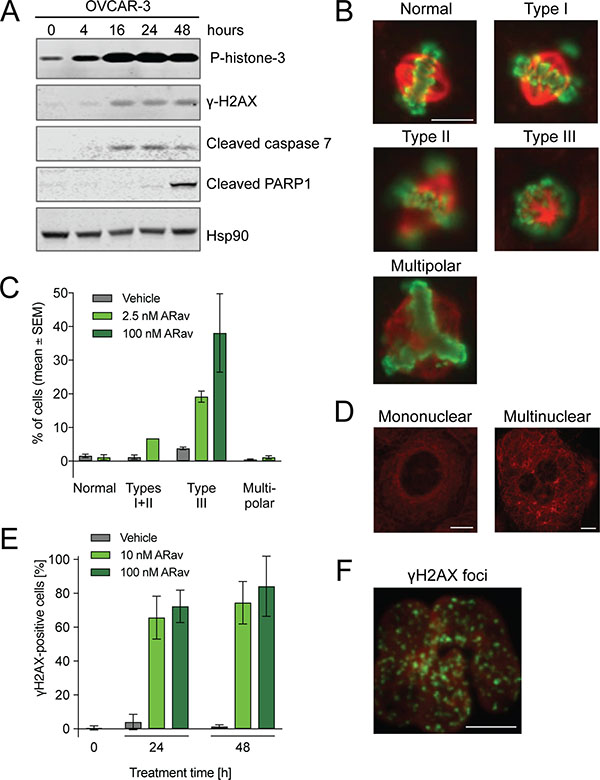 Analysis of anetumab ravtansine mode-of-action in OVCAR-3 human ovarian cancer cells.