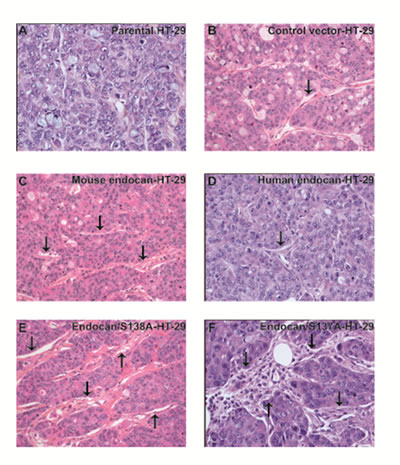 FIGURE 6: Pathological analysis of HT-29 tumors overexpressing endocan.