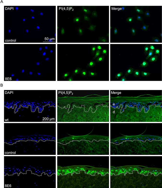 The nuclear PI(4,5)P2 pool is enriched in HPV8-E6 positive keratinocytes.