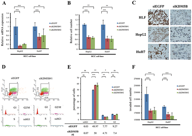 Involvement of KDM5B in the tumor growth and invasion of HCC cell lines.