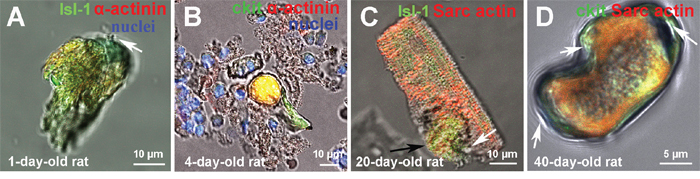 The examples of CSC development inside transitory amplifying cells (TACs) and young cardiomyocytes, revealed in a suspension of ex vivo freshly isolated myocardial cells of rats.