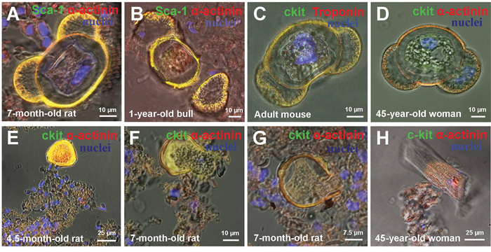 Rupture of cell-in-cell structures (CICSs) and release of transitory amplifying cells (TACs) in mammalian myocardium.
