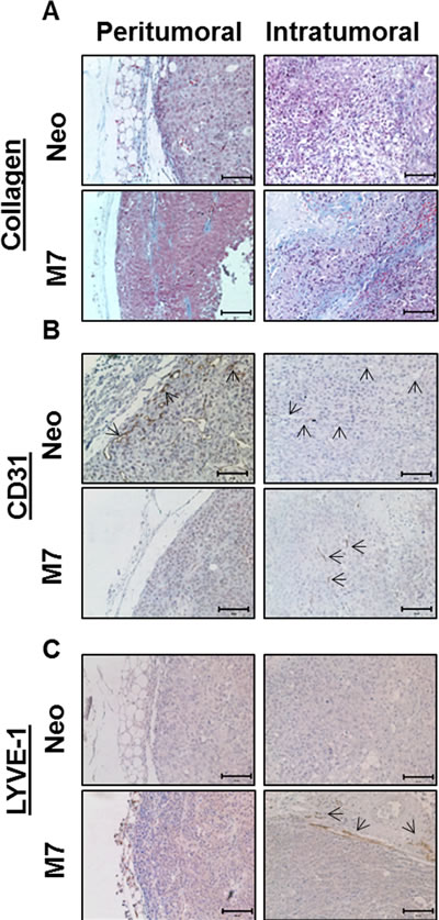 Characterization of maspin induced stromal reactivities.