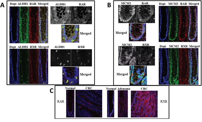 RAR and RXR-alpha retinoid receptors co-stain with ALDH1 but not with MCM2.