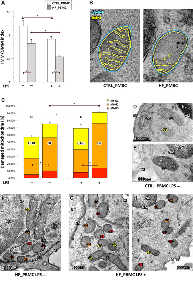 Quantitative analysis of ultrastructural damage in mitochondria from HF_ and CTRL_PBMCs.