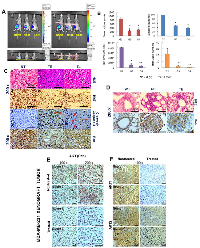 Pimozide reduces tumor burden, cell proliferation, and the number of lung metastases in a nude mice xenograft model system.