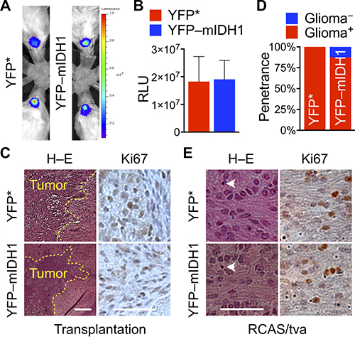 Loss of IDH1R132H suppression of tumor initiation and growth in orthotopic models.