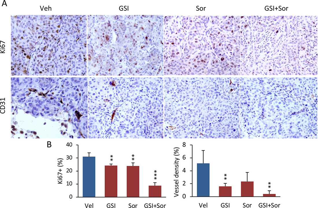 The combination of PF-03084014 with sorafenib inhibited tumor cell proliferation and tumor angiogenesis in mice.