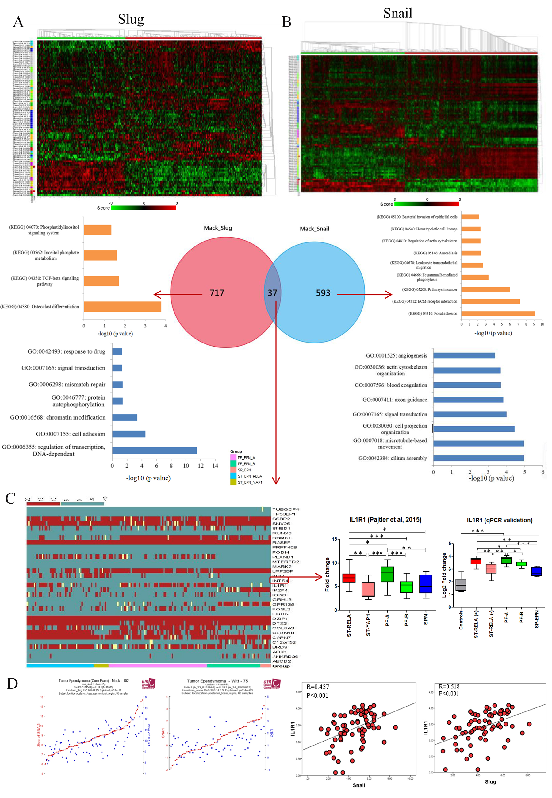 Co-expression network analysis of Snail and Slug and identification of IL1R1.