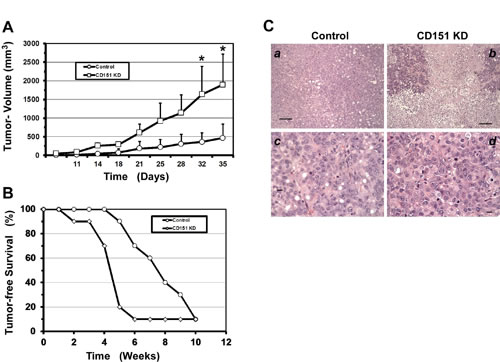CD151 ablation enhances ovarian tumor growth and ascites production.