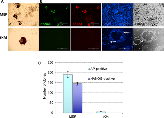 De novo immortalized fibroblasts (tKM cells) cannot be reprogrammed to iPSCs.