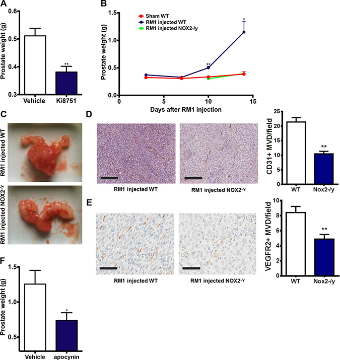 VEGFR2 and NOX2 activity are crucial for prostate tumour growth in mice.