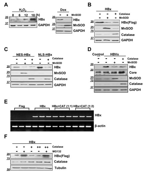 HBx protein levels are decreased by catalase or MnSOD independent of HBx localization.