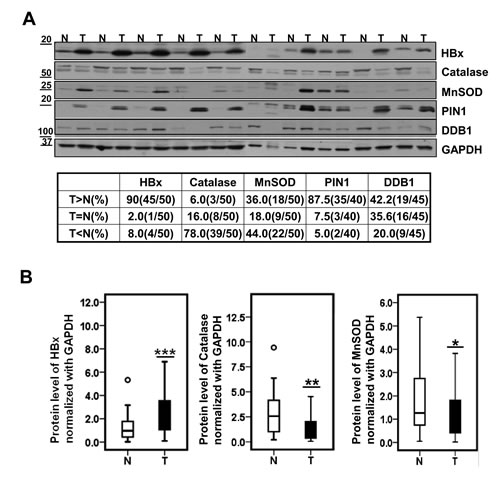 Catalase protein level is significantly lower in HBV-related HCC specimens.