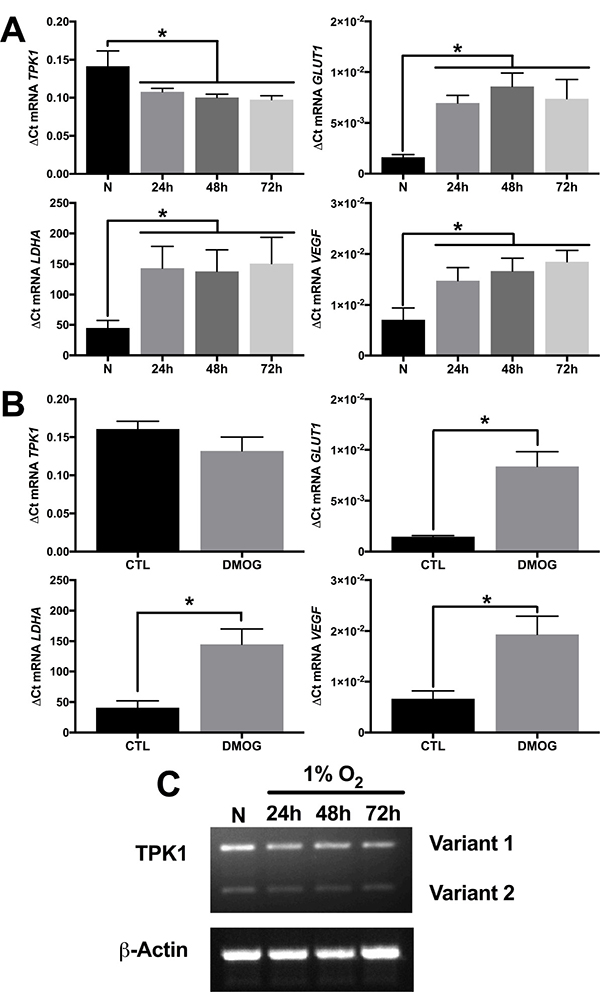 Increase in TPK1 protein expression lacks transcriptional involvement.