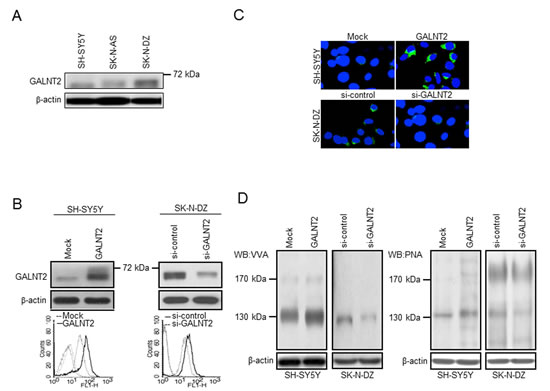 Stable transfection of NB cells with GALNT2.