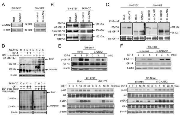GALNT2 modifies IGF-1R glycosylation and activity and modulates IGF-1R phosphorylation and signaling in NB cells.