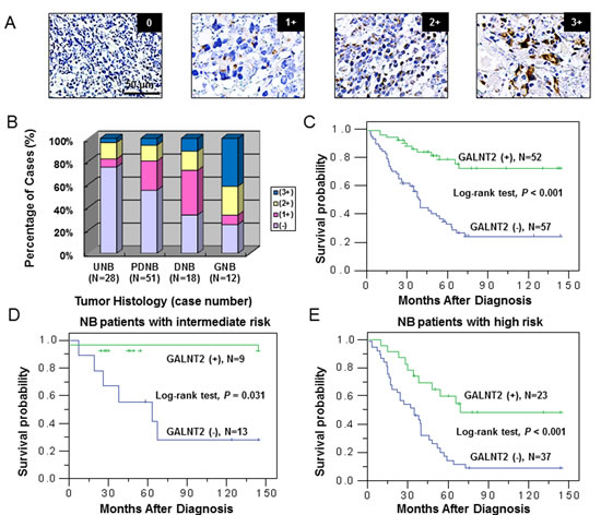 GALNT2 expression is correlated with tumor histology and survival probability of NB patients.
