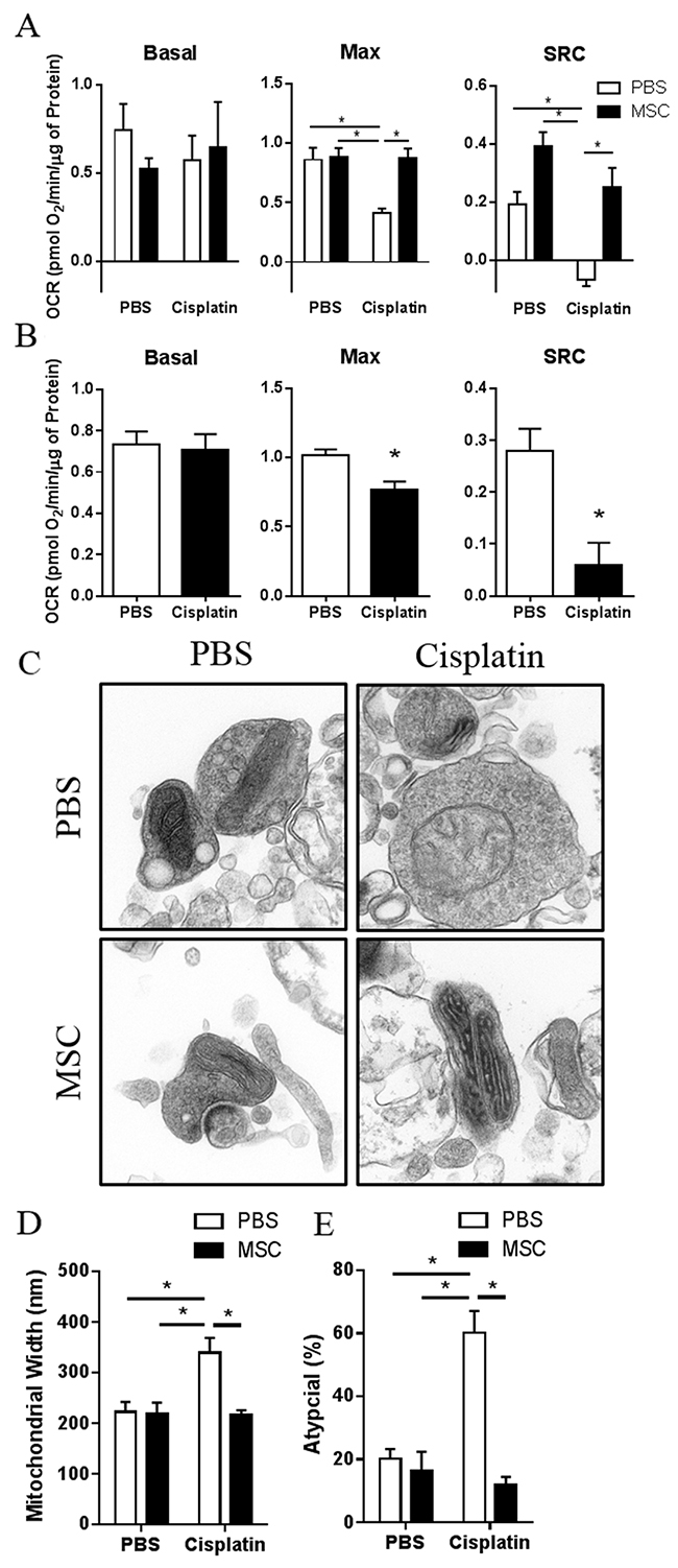 Effects of nasally administered MSC on cisplatin-induced changes in mitochondrial respiratory function and mitochondrial morphology.