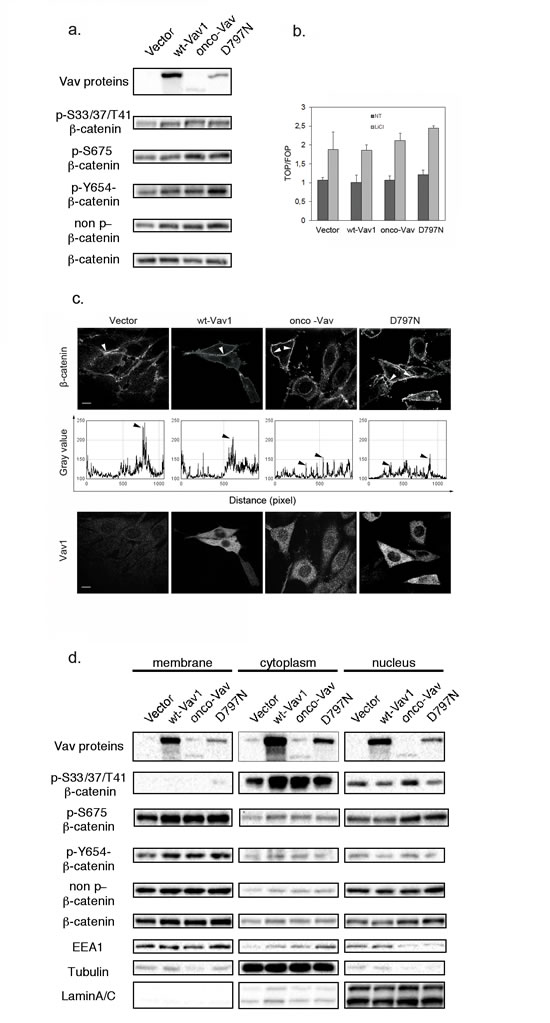 Vav1 influences &#x3b2;-catenin phosphorylation and subcellular localization.