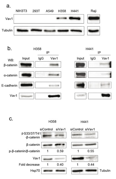 Vav1 interacts with &#x3b2;-catenin in lung epithelial cancer cell lines.