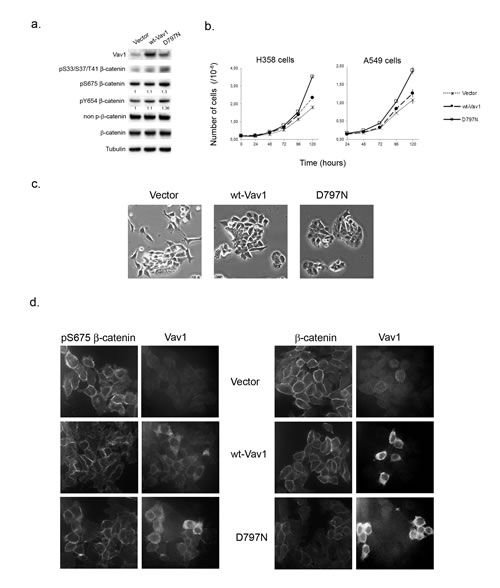 Ectopic expression of Vav1 allows modulation of &#x3b2;-catenin in lung cancer cells.