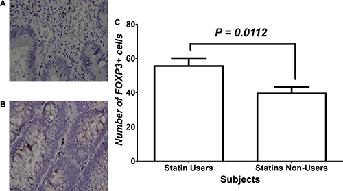 Immunohistochemical analysis of FOXP3+ cells within CRC tissues of study groups.