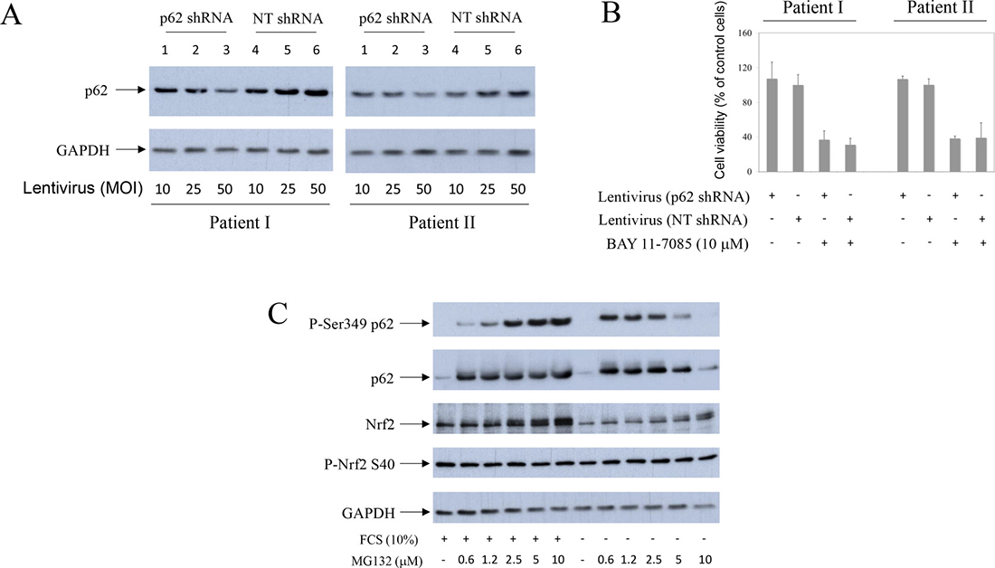 Partial knock-down of p62 does not change human synovial fibroblast fate upon BAY 11-7085 treatment.