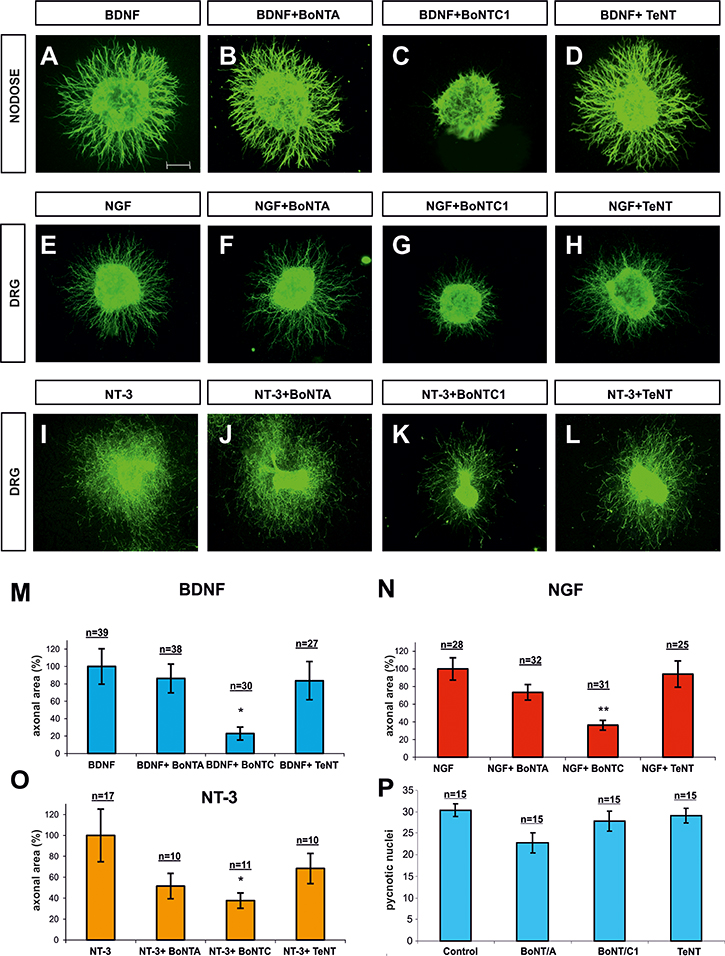 Confocal images of Nodose and DRG explants co-cultured in collagen gel.