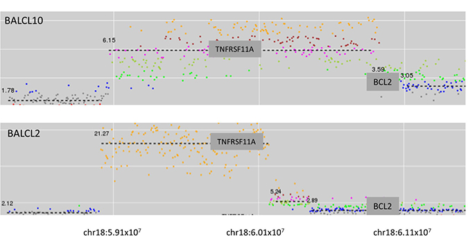 Two cases of breast implant-associated anaplastic large cell lymphoma with high level amplification of TNFRSF11A (RANK).