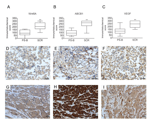 Expression of Wnt5A, ABCB1 and VEGF is associated with clinical chemoresistance in breast cancer patients.