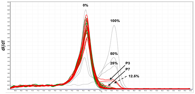 MS-HRM analyses of amplified PLA2R1 sequences covering nine 5&#x2032;-CpG-sites [35] after isolation and bisulfite modification of cfDNA from serum of healthy individuals and patients with prostate cancer (as described in Table 2).