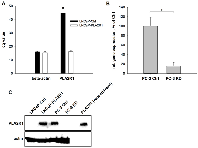 Phospholipase A2 receptor 1 (PLA2R1) expression was assessed in transfected LNCaP (LNCaP-PLA2R1) and PC-3 (PC-3 KD) cells or control vector-transfected cells (Ctrl).