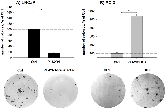 Clonogenicity was assessed in PLA2R1-transfected LNCaP cells (LNCaP-PLA2R1) and PLA2R1-knockdown PC-3 cells (PLA2R1 KD) in comparison to control vector-transfected cells (Ctrl).