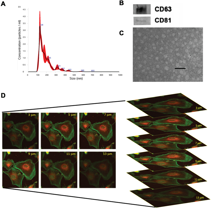 Characterization of EVs isolated from HLSCs.