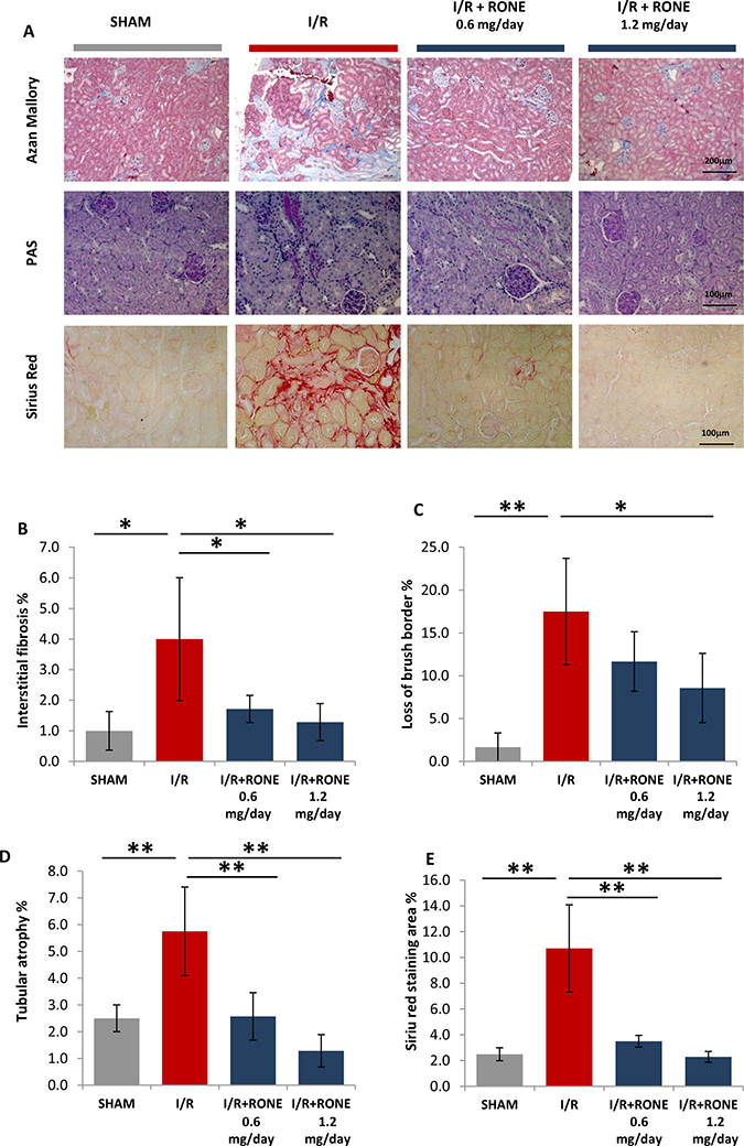 HPSE inhibition ameliorates renal injury and interstitial fibrosis induced I/R.