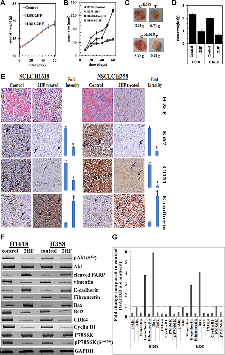 Anticancer activity of 2HF towards SCLC and NSCLC.