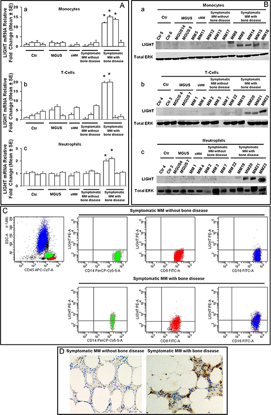 LIGHT expression in patients and controls.