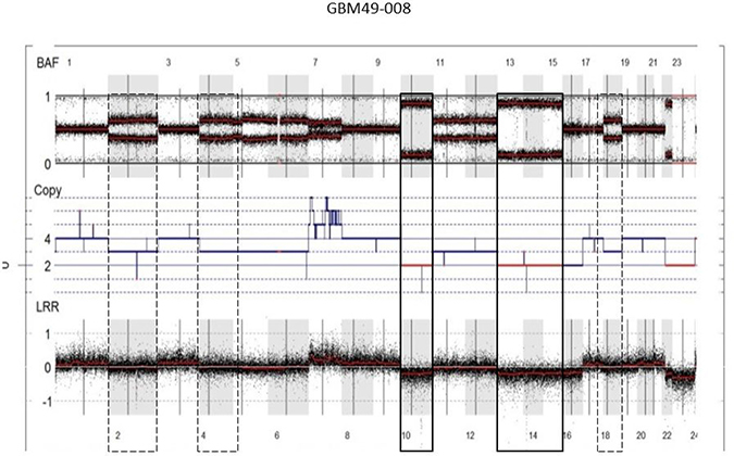 Chronology of genetic events in WGD GBM.