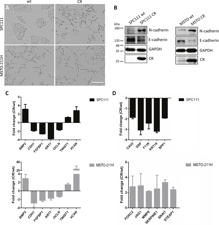 CR overexpression in MM cells induces EMT.