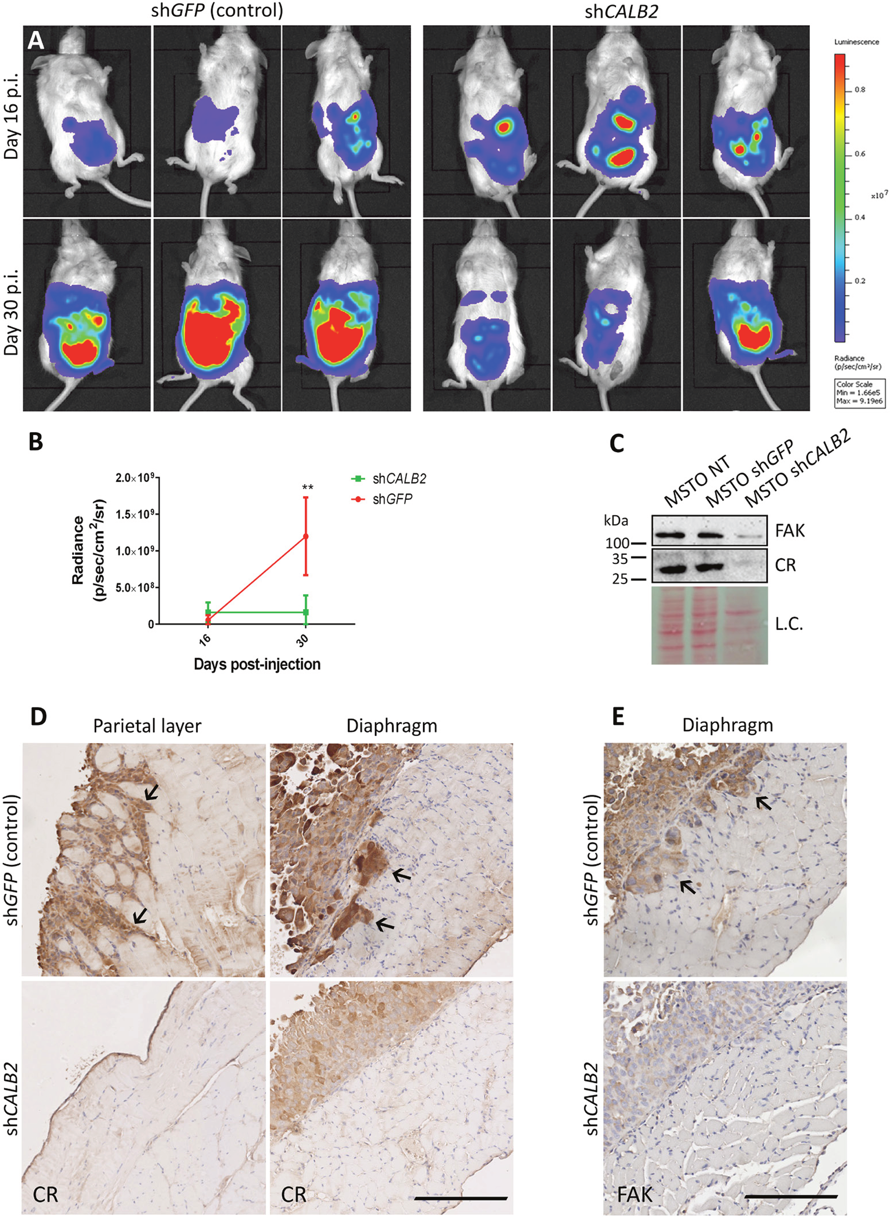 CR downregulation in vivo impairs tumor progression in a MM orthotopic xenograft mouse model.
