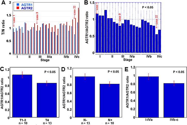 AGTR1 and AGTR2 mRNA expression in 23 OSCC cases.