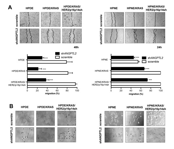 Silencing the expression of ANGPTL2 modulates migratory properties in HPDE and HPNE /KRAS, /KRAS/HER2/p16p14shRNA cell lines.