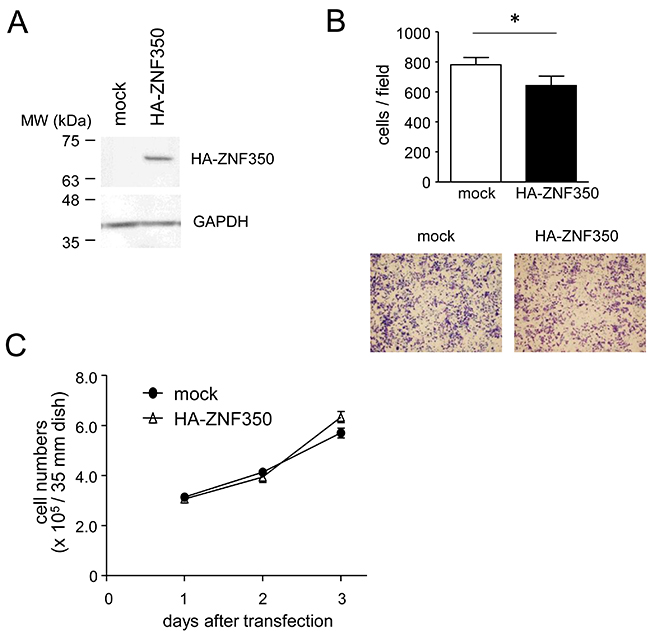 Loss of migratory capacity in ZNF350-overexpressing MG cells.