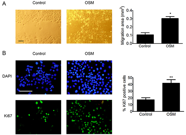 OSM increases the migration and proliferation o PDVC57 cells.