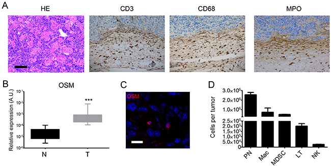 Mouse tumors are moderately differentiated cSCC associated with OSM overexpression by infiltrating neutrophils.