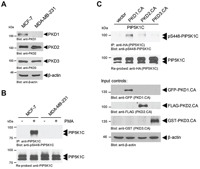 Phosphorylation of PIP5K1C at S448 in BC cells is mediated by PKD1.