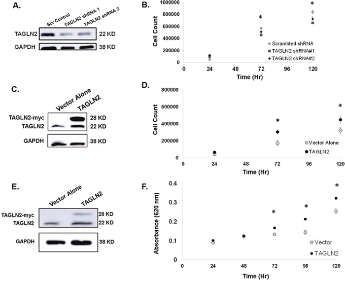 TAGLN2 regulates proliferation of IDH1/2 WT GBM cells in vitro.