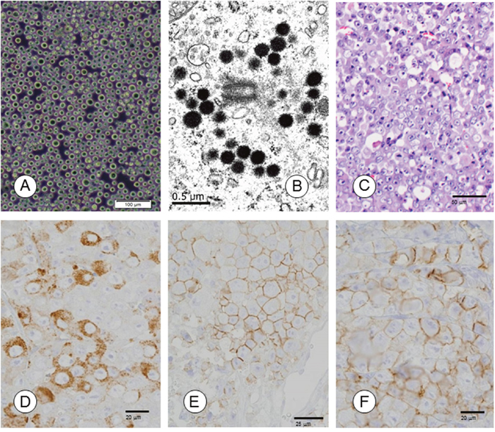 Morphological and immunohistochemical characterization of TCC-NECT-2 cell line.