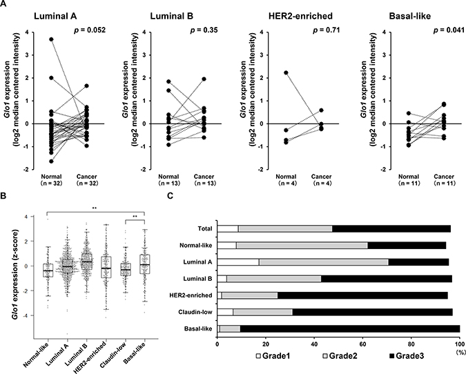 Glo1 is overexpressed in basal-like breast cancers.